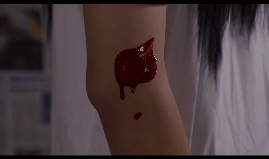 Advertising film still — a blood-stained arm